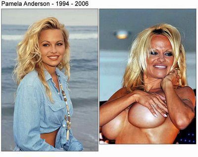 Pamela Anderson
